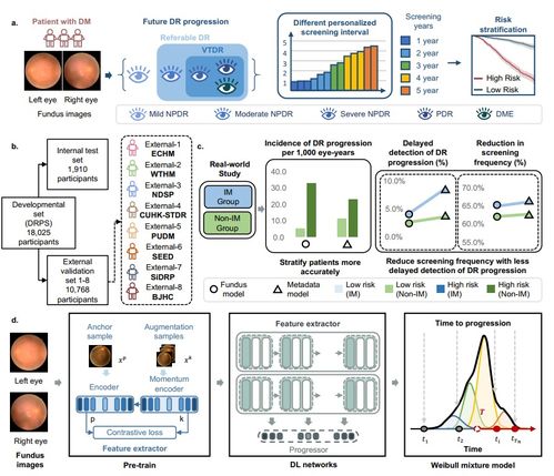 DeepDR Plus系统 清华大学与上海交通大学团队合作助力糖尿病视网膜病变精准预测与防控